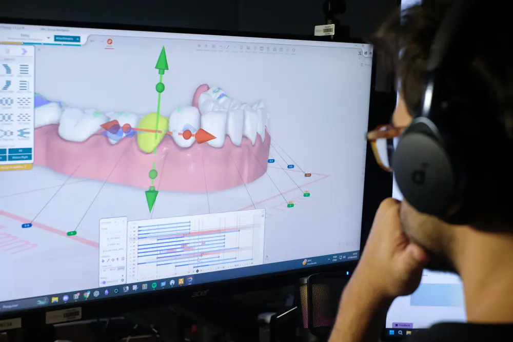 planejador trabalhando no software 3d de movimentação dentária